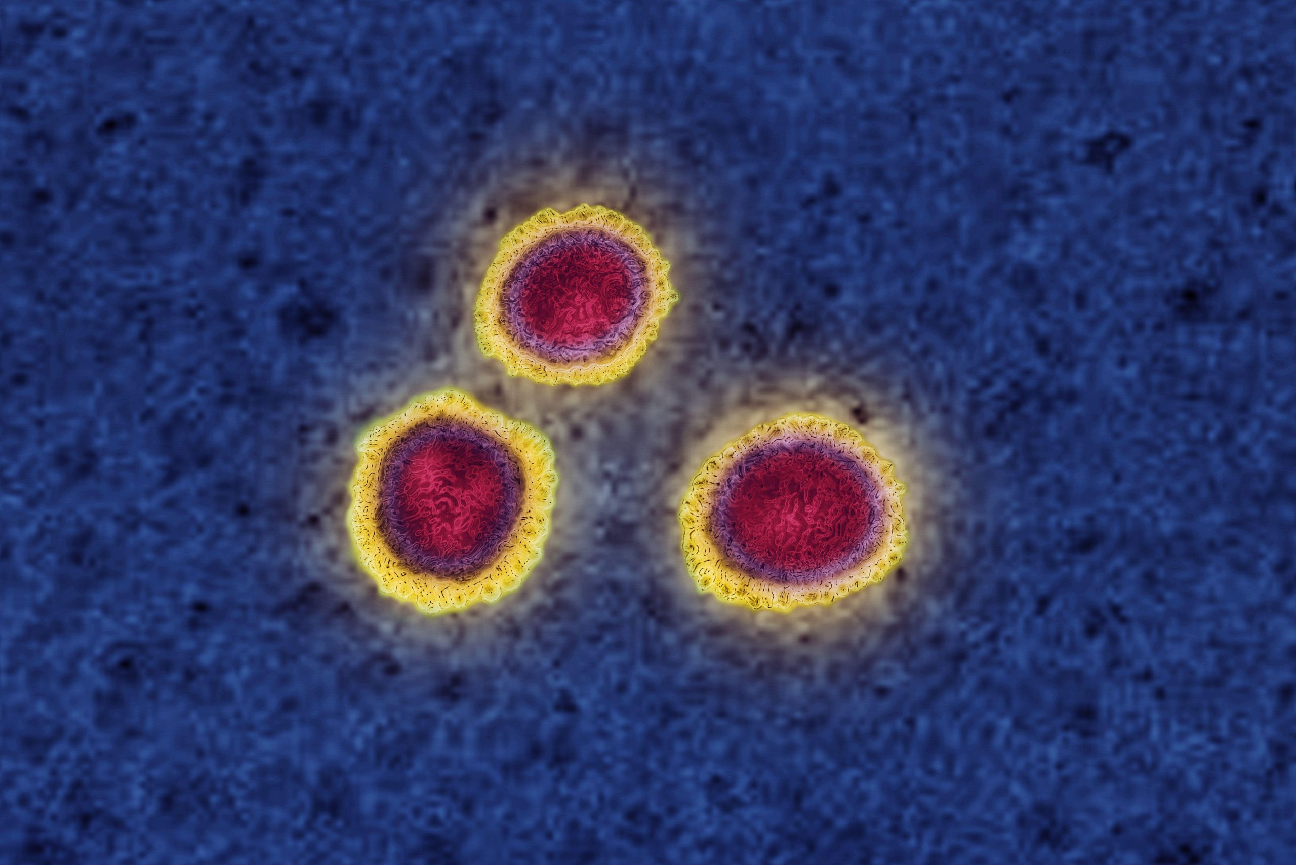 Атакующие клетки. Coronaviridae. Mers-cov под микроскопом.